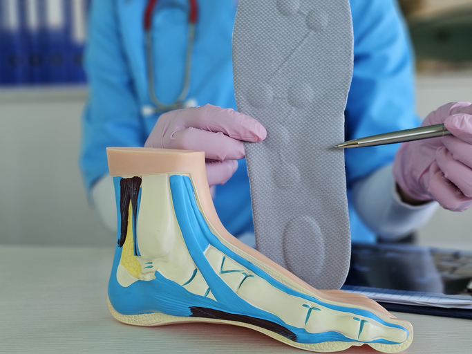 Detailed examination of a foot model showcasing anatomy and orthotic fitting techniques